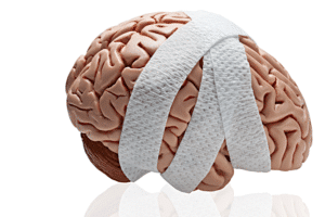 Image of fake brain wrapped in bandage